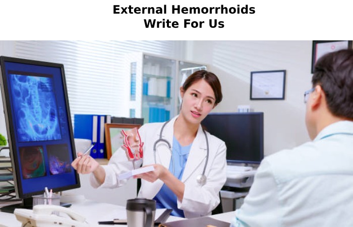 External Hemorrhoids Write For Us